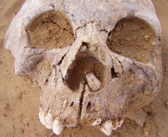 Example skull of Neolithic people. Source: (Author provided/ The Conversation)