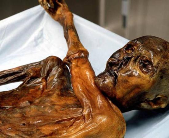 Otzi the Iceman mummy.