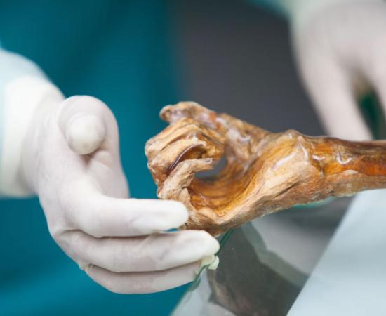 Ötzi the Iceman mummy in the South Tyrol Museum of Archaeology.