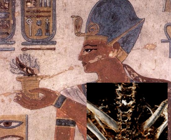 Ramesses III was Murdered by Multiple Assailants Then Received Postmortem Cosmetic Surgery to Hide it