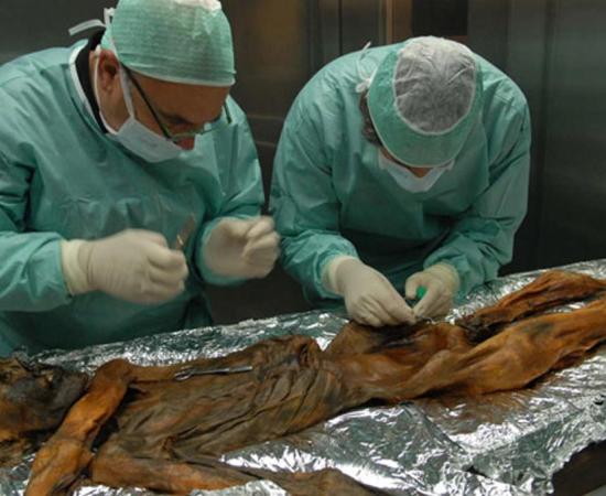 Researchers take a sample from Iceman's hip in 2014. 