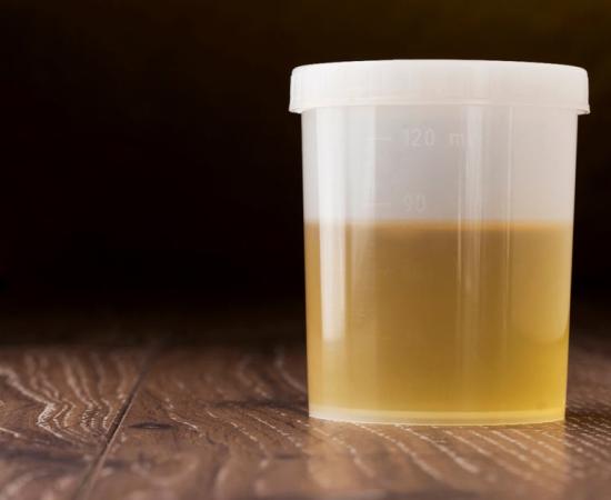 While today we flush our urine away without giving it a second thought, in ancient times it was considered a valuable commodity. Urine contains a wide array of important minerals and chemicals such as phosphorus and potassium. The Romans believed that urine – both human and animal - would make their teeth whiter and keep them from decaying, so they used it as a mouthwash and mixed it with pummis to make toothpaste. In fact, urine was so effective that it was used in toothpastes and mouthwashes up until the 