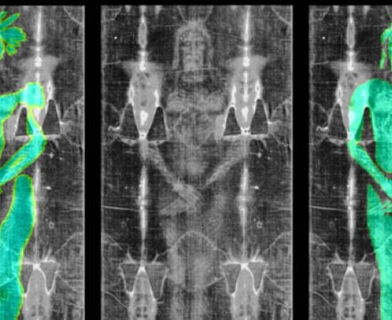) Overlay of the texture generated by the 3D model onto the image of the Shroud of Turin, showing misalignment in anatomical proportions