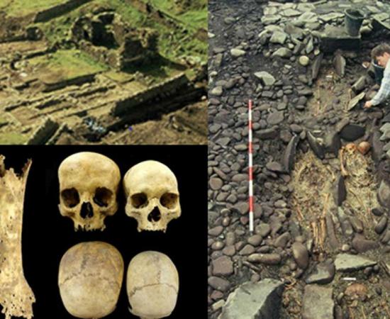 Isle of May monastery ruins (Peter Yeoman) top left; Skeletal remains on May (Peter Yeoman/ British Archaeology Magazine); The foot bones of a teenager with syphilis (left). An enlarged skull, possibly due to hydrocephaly (right). (Images: Marlo Willows/British Archaeology) bottom left.