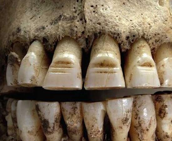 This Swedish Viking had filed front teeth. 