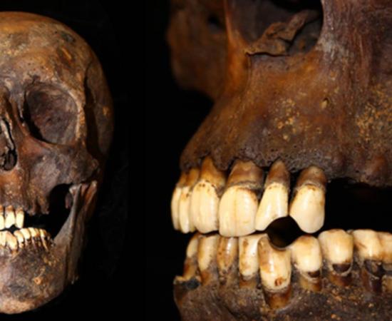 Skull and jaw from the remains used in the study.