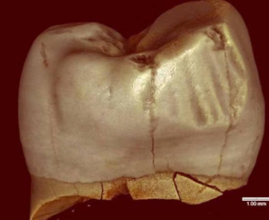 A Neanderthal molar scanned showing grooves.