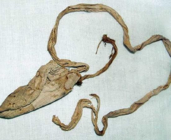 Tutankhamun’s condom.	Source: Cairo Museum, Egypt