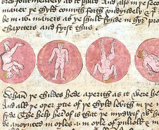 Medieval medical text 