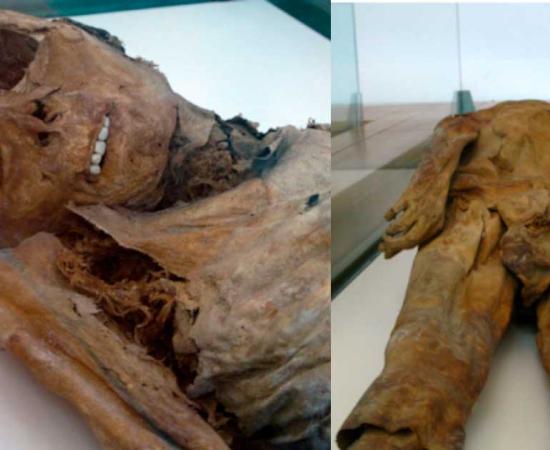 Two of the creepily preserved Venzone mummies. With normal decomposition, teeth tend to fall out several weeks after death. Source: Left; Joadl / CC BY SA 3.0 Right; Joadl / CC BY SA 3.0