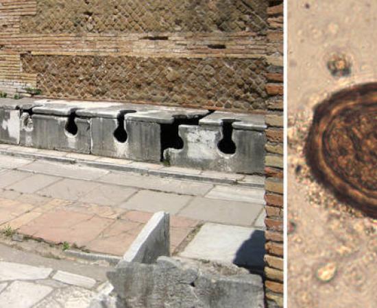 Roman latrines and Vindolanda parasite.
