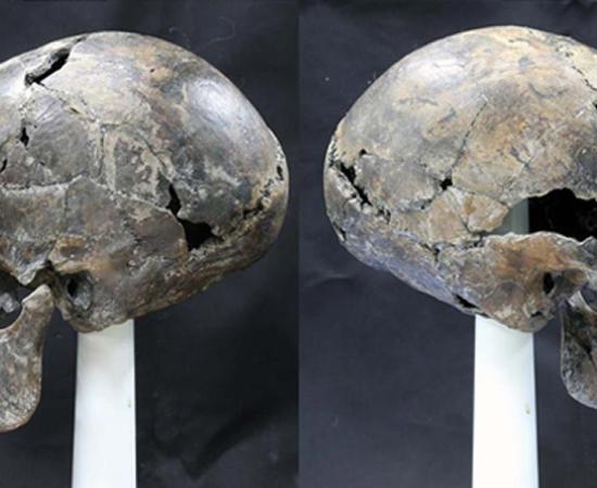 Bizarre Alien-Like Skull Unearthed in Korea was Naturally Formed