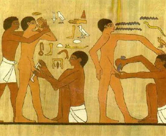 Drawing on a tomb/wall from Ankhmahor, Sakkara, Egypt, of an adult circumcision. Source: Public Domain