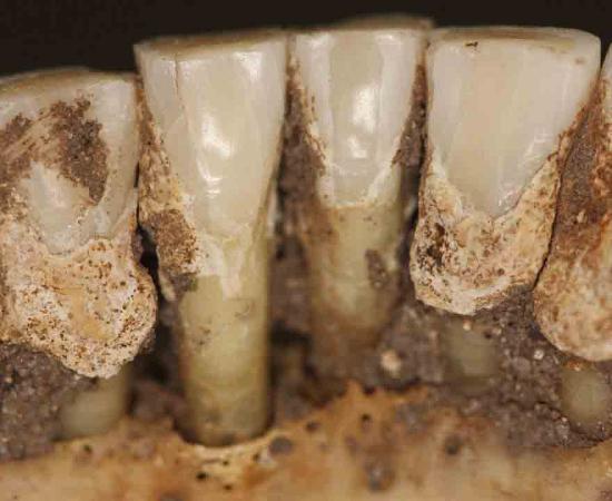 New study will help us understand more about ancient trippers by testing ancient teeth. Source: Line S. Larsen / Science
