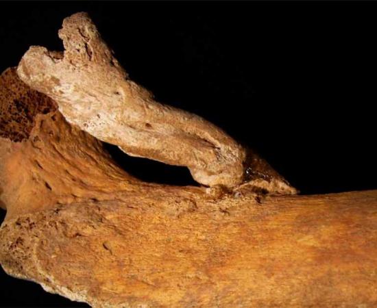 Curious bone growth on the femur of an adult female in Constância, Portugal. Source: ©Sandra Assis/International Journal of Paleopathology