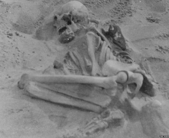 The bent and hunched bones of the woman with rickets. (Images by the journal Proceedings of the Prehistoric Society)