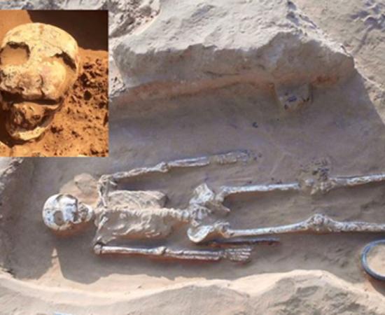 Burial Number 12 at Bogomolny, warrior with evidence of brain surgery by trepanning in skull. Inset, close up of trepanned skull  