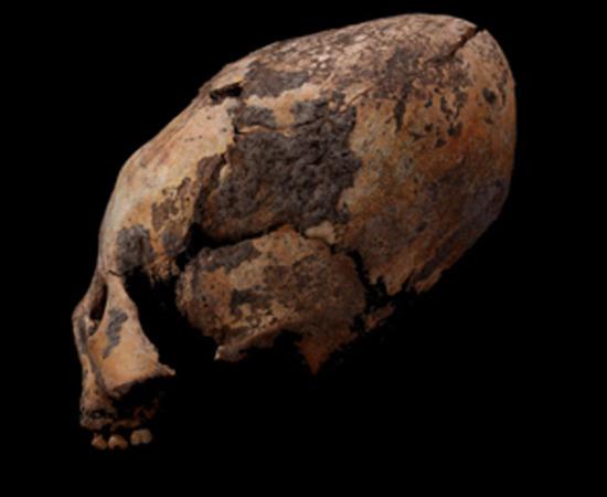 One of the oddly shaped human skulls discovered in northeastern China. Source: Q Wang / Fair Use.