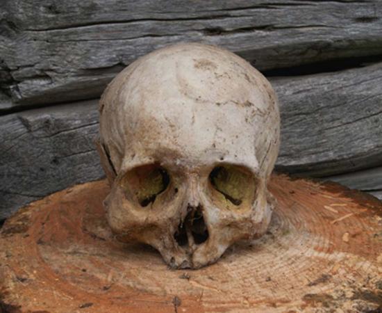 Human skulls have been found with evidence of craniotomy.