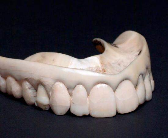 Upper ivory denture with human teeth. Source: Science Museum, London / CC BY 4.0