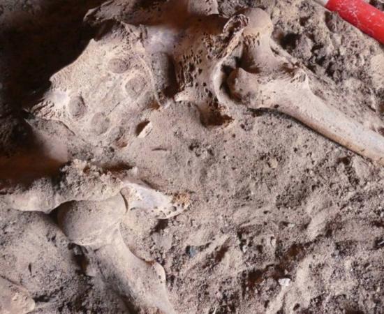 Earliest known breast cancer identified in ancient Egyptian skeleton