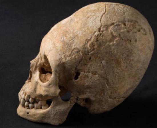Elongated Skull - France