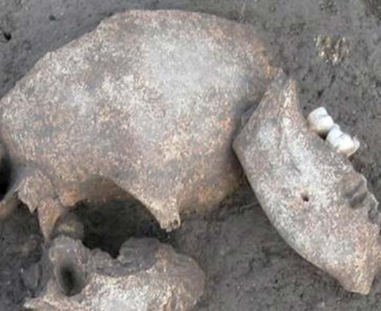 Skulls found at Le Cailar archaeological site show signs that the heads were embalmed. 