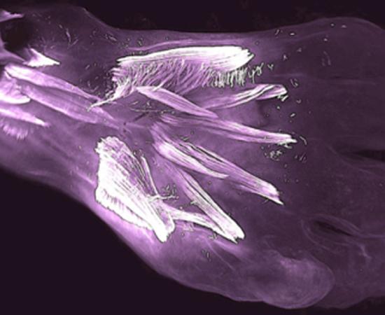 Muscles in the back of a 10 week old human embryo’s hand called dorsometacarpales (the two smallest horizontal muscles highlighted at center) will be lost or fuse with other muscles during development. Source: Diogo, Siomava, Gitton.