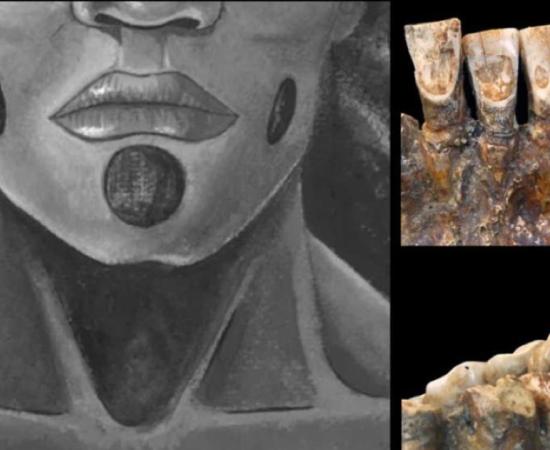 Teeth of OH1 (John C Willman) and the proposed facial piercings. (Lou-Octavia Mørch)