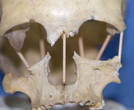 Genetic Study of Romanian Skull Upends Previous Theories of Evolution