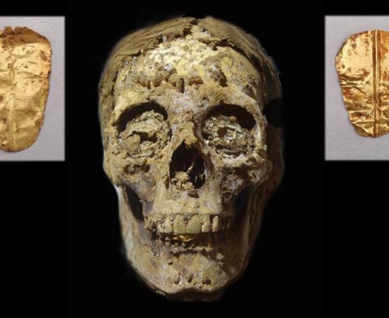 The man’s skull with golden tongue clearly visible was discovered during excavations at Oxyrhynchus. Source: Ministry of Tourism and Antiquities