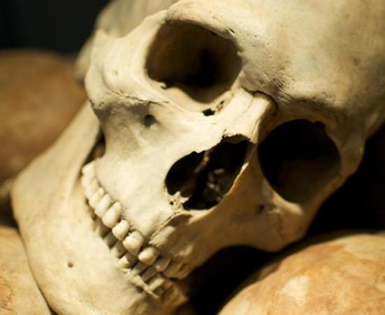 Human skull with well-preserved teeth