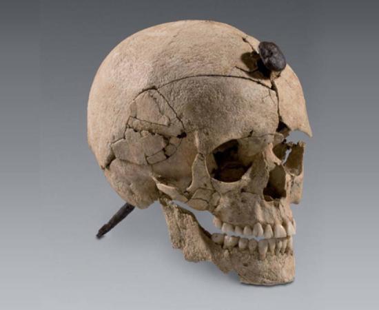 Iron Age Iberian skull with nail driven through its head, recovered by archaeologists at site in Ullastret, Spain.