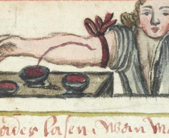 Bloodletting was treatment for infection in the past. 