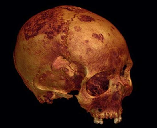 A rendering of the ancient skull created from CT scans.