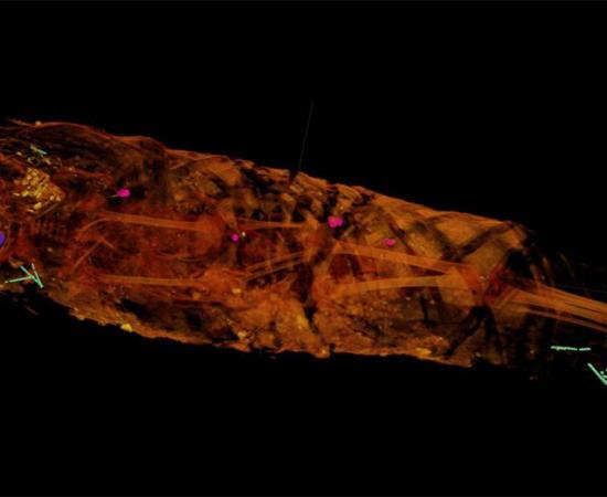 Tech Reveals A Little Girl Mummy Who Doesn’t Look Like Her Portrait