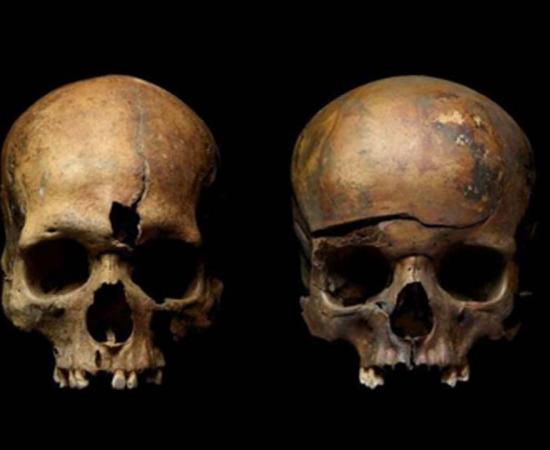 Skulls from mass grave in Yaroslavl, Russia, showing traces of violence. Source: Institute of Archaeology, Russian Academy of Sciences
