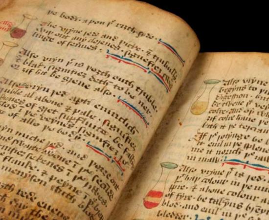 Medieval medicine manuscript with drawings of urine flasks, illustrating the different colors of a patient's urine, with their ailments described alongside, 15th century. Source: © University of Cambridge