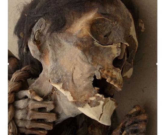 Pre-Columbian mummies Chile - arsenic poisoning
