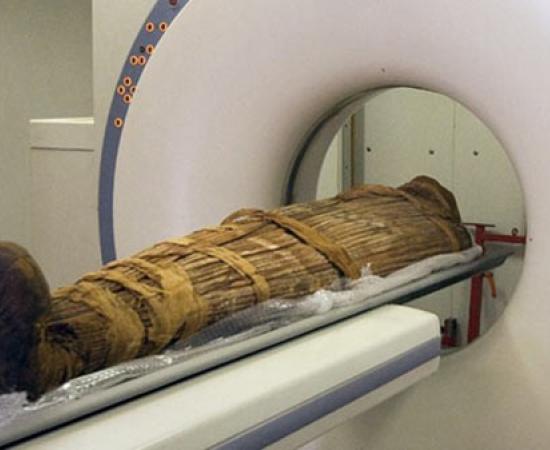 Hi-tech scans of ancient mummies from around the world show evidence of heart disease