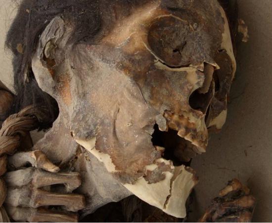 A mummy tested for arsenic poisoning.