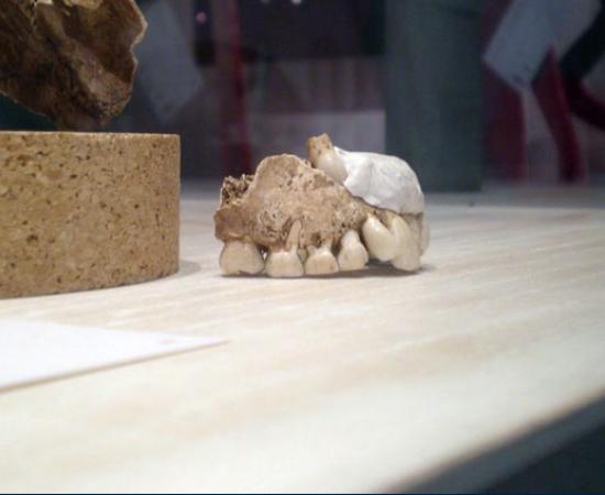 Neanderthal Teeth