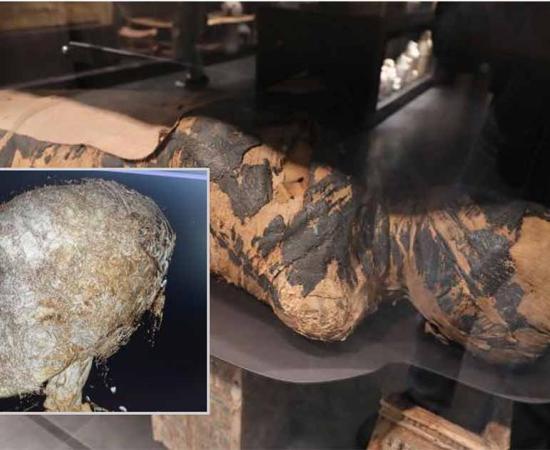 The mummified 2,000-year-old Egyptian woman at The National Museum in Warsaw, who has been examined as part of a medical project to better understand cancer origins. Source: Pawel Supernak / Science in Poland