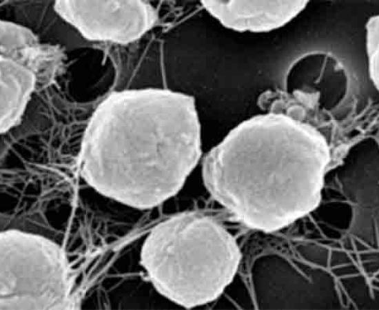 Life Origins - Organisms like Archaea