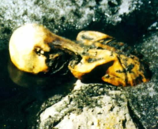 The upper body of Ötzi, protruding from the ice in the Tisenjoch pass on September 19, 1991. Photo: Helmut Simon. Used with kind permission from Erika Simon. Source: Erika Simon/SAGE Journals