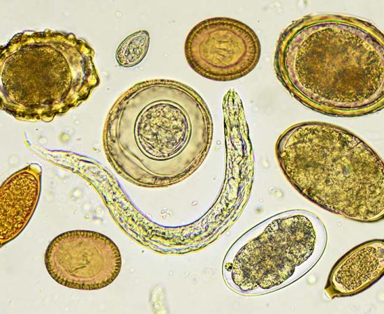 Selection of helminthes, or parasitic worms, under a microscope. Source: jarun011 / Adobe Stock