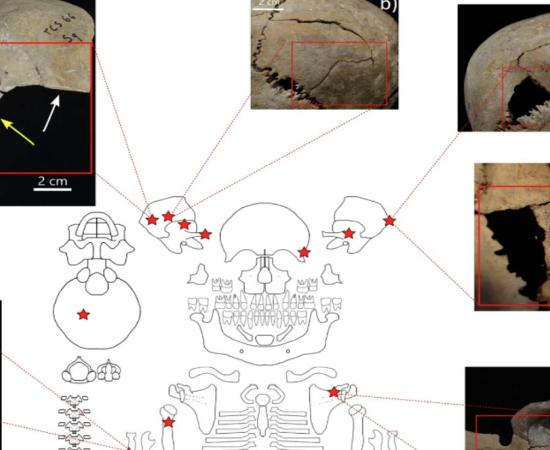 Distribution and examples of perimortem skeletal lesions at Cornaux