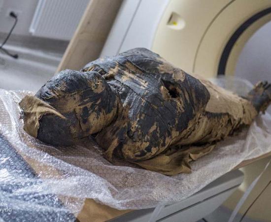 X-ray and CT scans of the mummified body show that the woman died when she was between 20-30 years old. (O. Leydo)