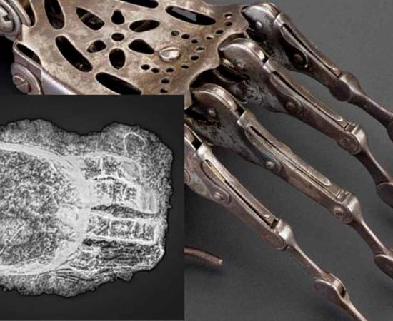 Main: An historical prosthetic hand (The Board of Trustees of the Science Museum). Inset: A scan of the prosthetic hand found in Freising (Bavarian State Office for Monument Preservation).