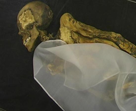 Ancient Siberian princess use cannabis to cope with breast cance